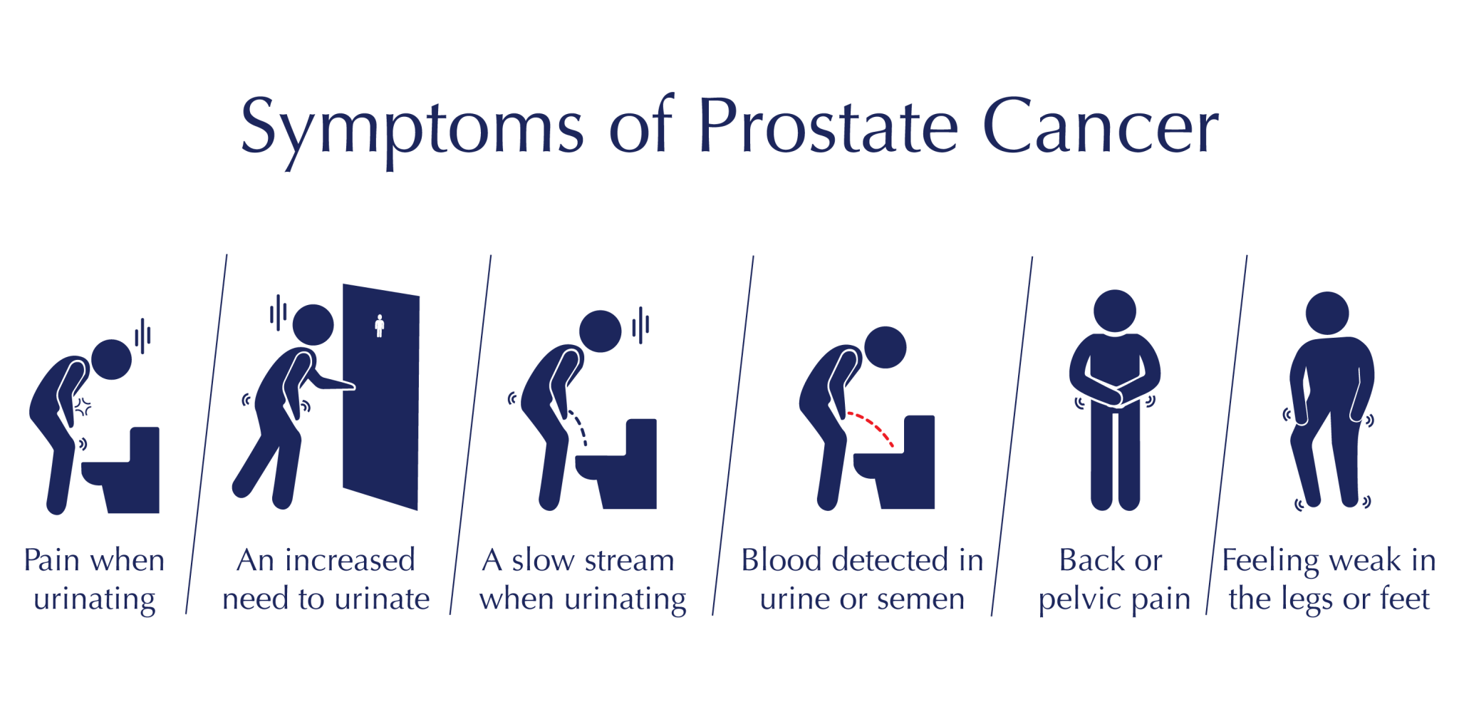 Prostate Cancer Symptoms Diagnosis Treatment In Sydney Katelaris 